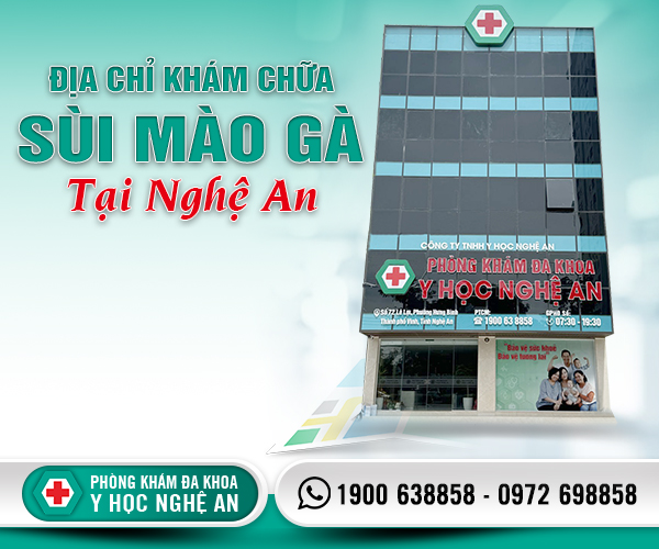 Địa chỉ khám chữa sùi mào gà ở Nghệ An